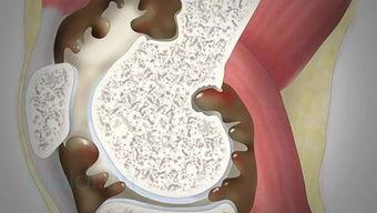 国产膝关节样品视频